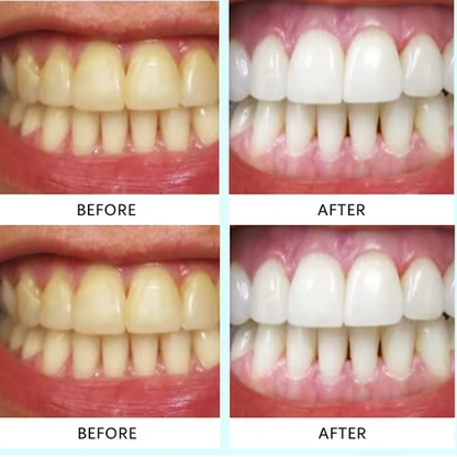 Teeth Whitening Strips (box3)