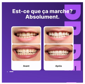 Teeth Whitening Strips (box3)