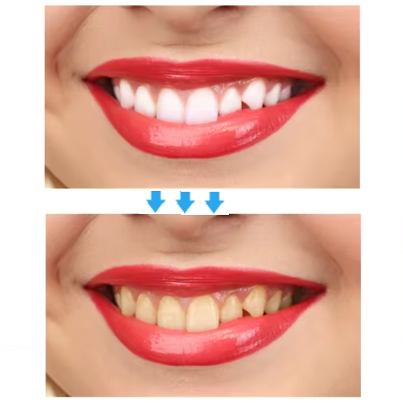 Tiras Blanqueadoras Dentales (caja1)