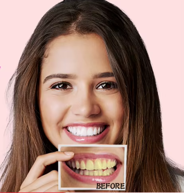 Teeth Whitening Strips (box3)