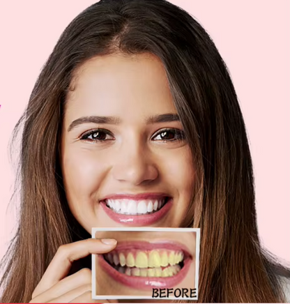 Teeth Whitening Strips (box3)